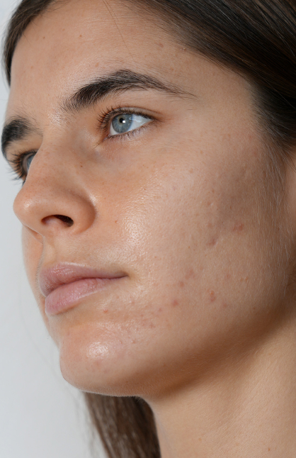 Image d’avant/après